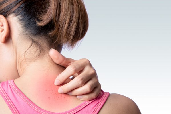 Cellulitis is a skin infection that occurs when bacteria enter through cuts. Left untreated, it is extremely painful. Learn more about risk factors for cellulitis, as well as how to prevent it.