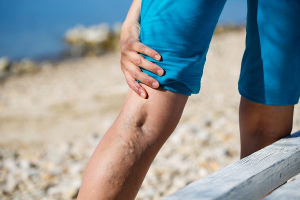 Leg cramps are due to a number of different conditions, including vein disease. Learn more about the causes of leg cramps and what type of doctor can help.