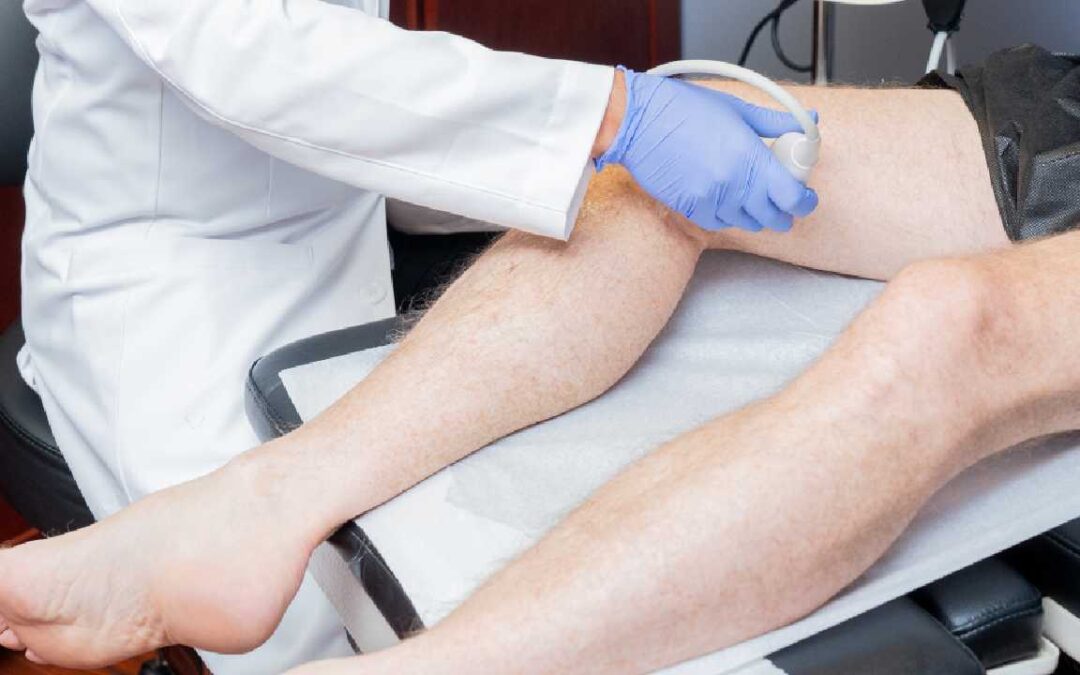 Is Sclerotherapy Safe? Vein Specialist explains the Benefits