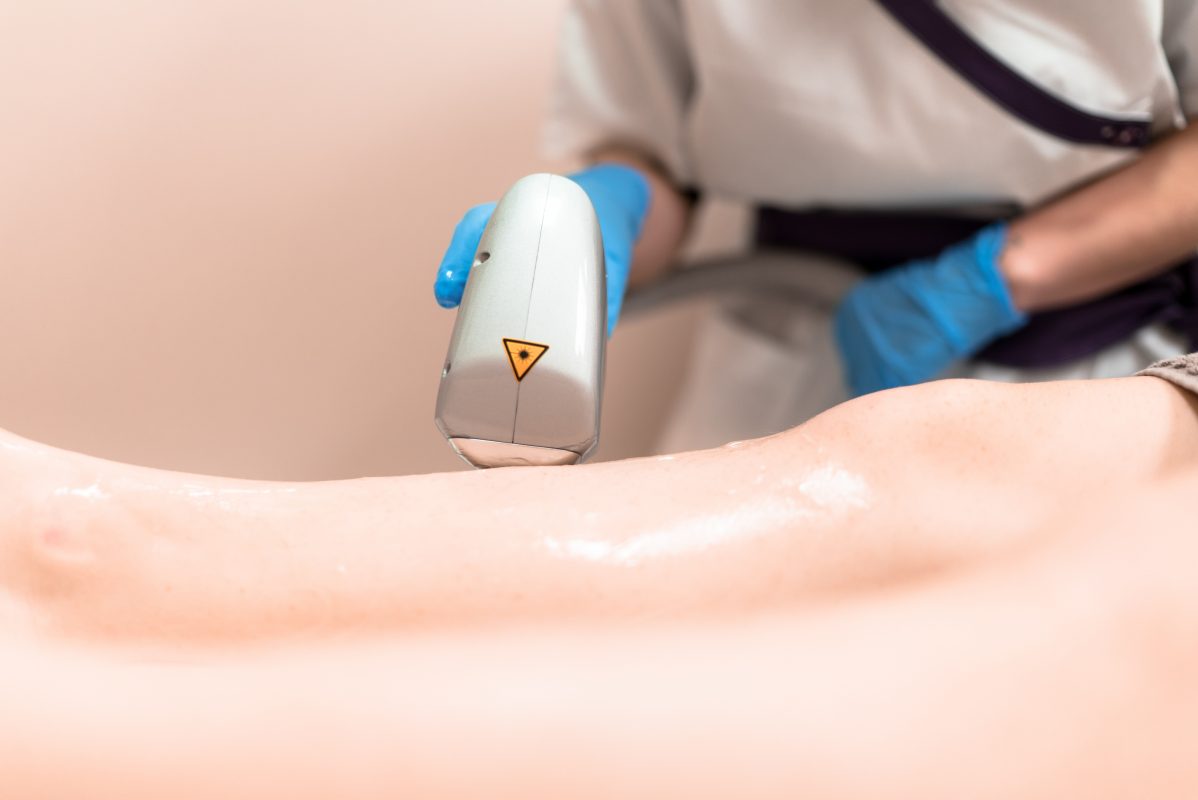 endovenous laser treatment Voted #1 Vein Doctors, Ivy League -Trained Board Certified Vein Doctors offering the latest treatments for Spider and Varicose Veins