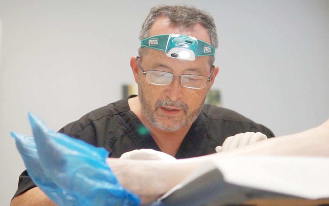 Laser Treatment for Varicose Veins: What You Need to Know