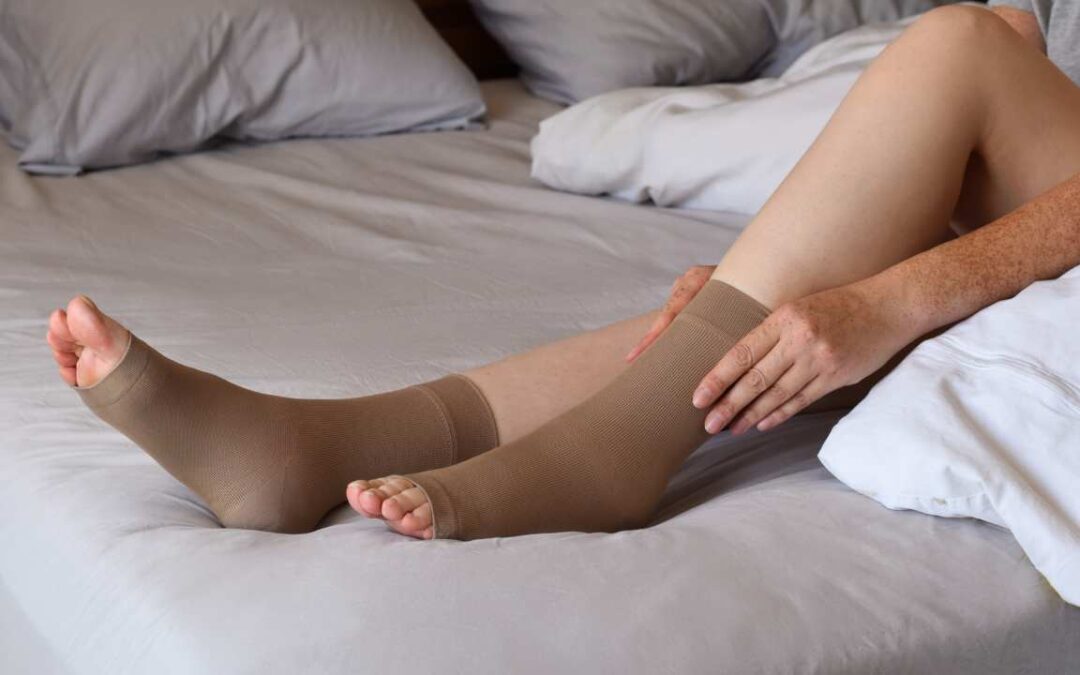 Do Compression Socks Help Varicose Veins? Top vein Treatment