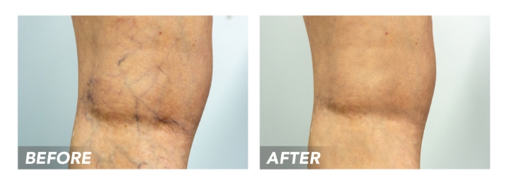 Looking for a Great NY Vein Clinic? Vip Medical Center Has Its Flagship Location in New York.