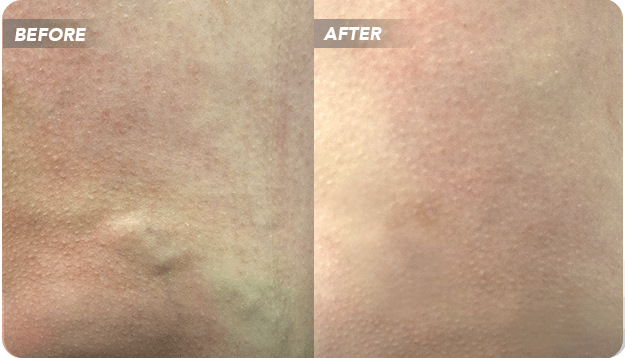 VTC-Before-After-1 VTC Before-After-1
