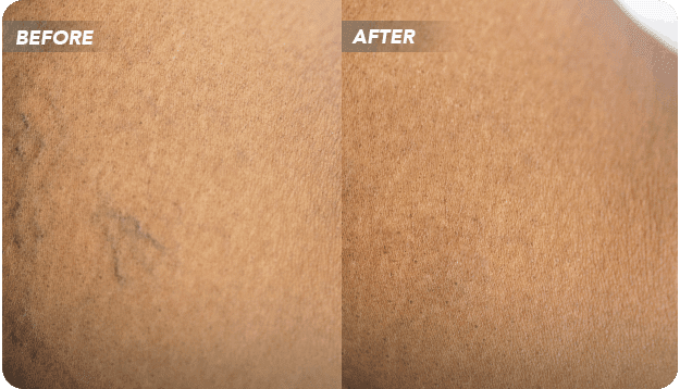 VTC-Before-After-11 VTC Before-After-11