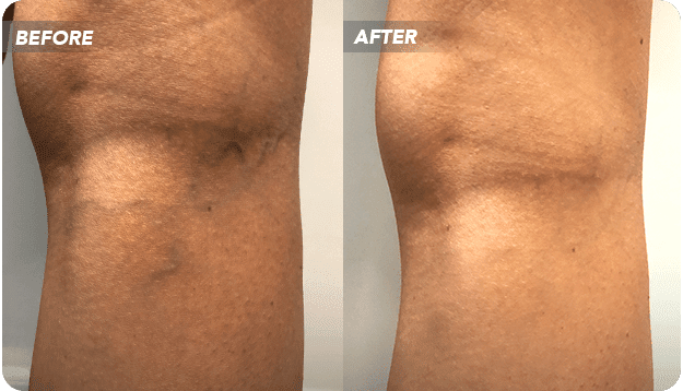 Vein Treatment Clinic: Vip Medical Center’s Premier Varicose Vein Clinic in LI Is Now Operating from Two Locations!