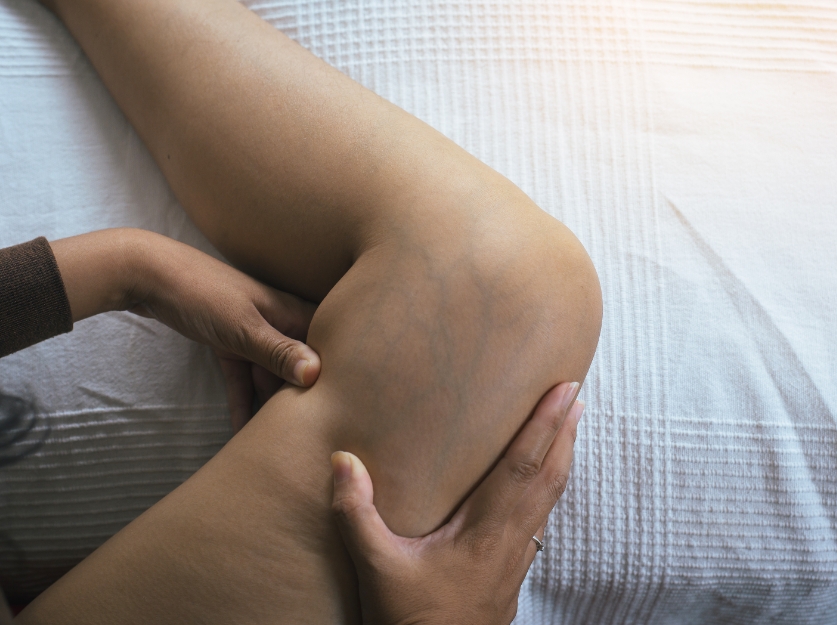 does fibroid removal affect hormones?