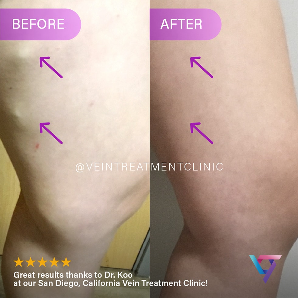 B&A 6 VTC Before-After-5