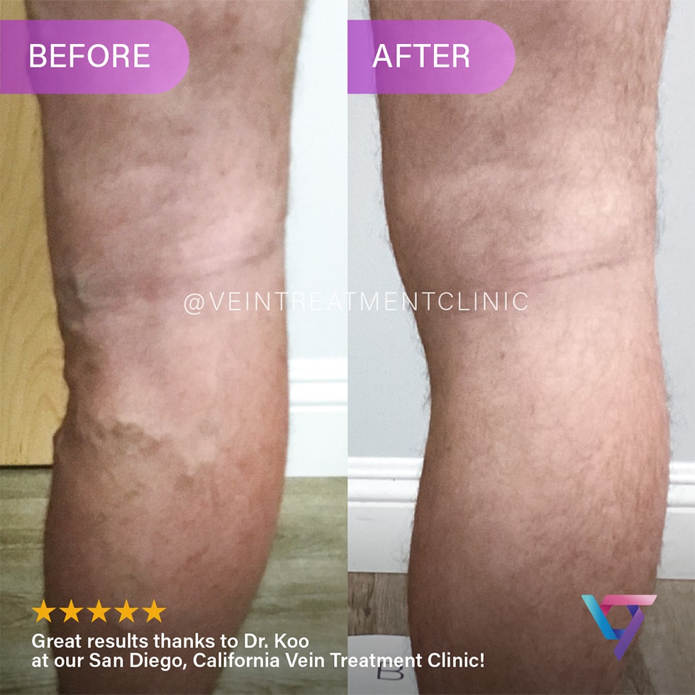 B&A 8 VTC Before-After-7