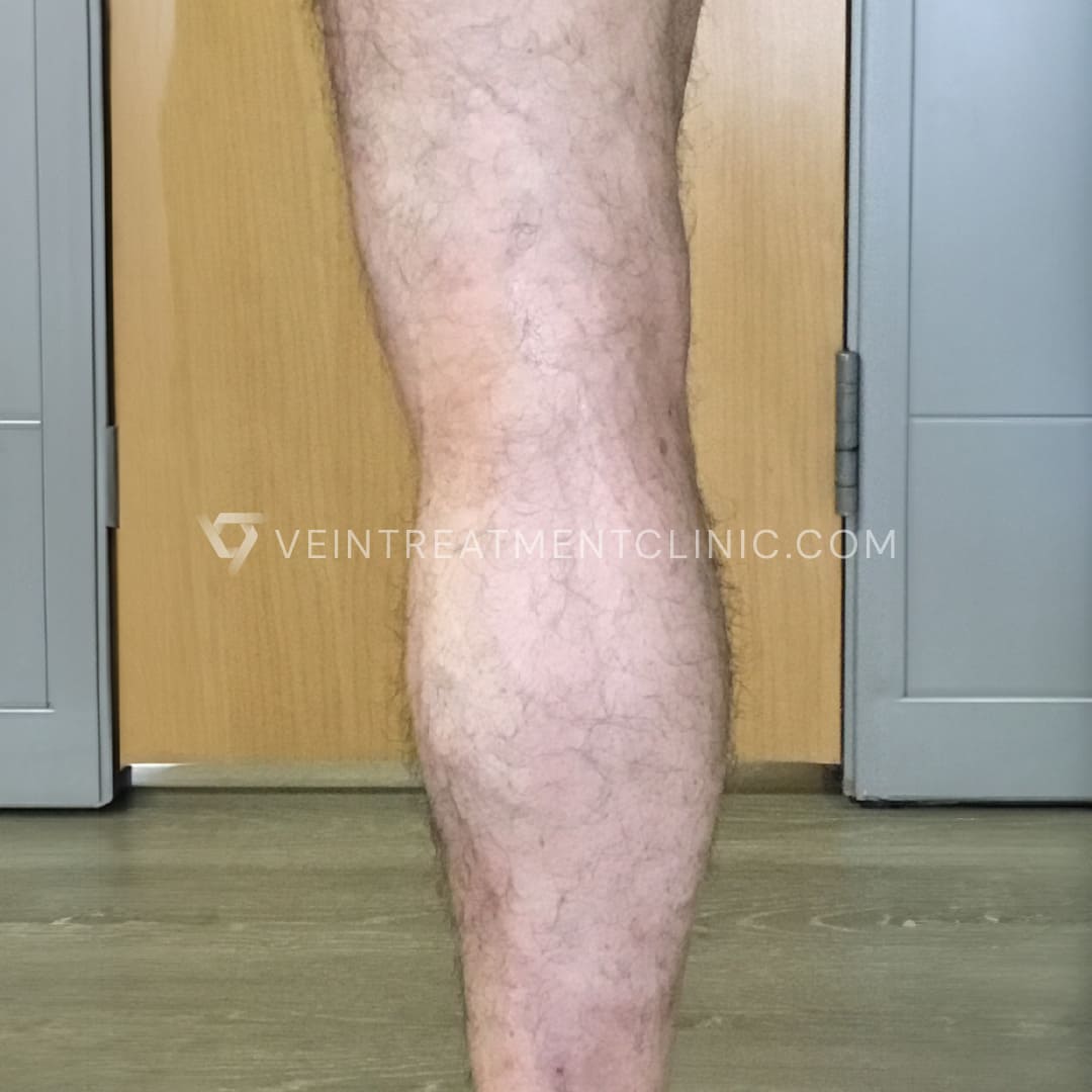 BA8_61+_VV after