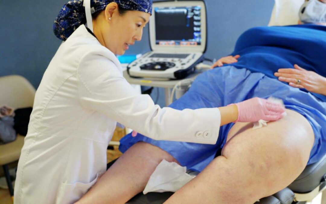 5 Top Spider Vein Treatments That Will Change Your Life!