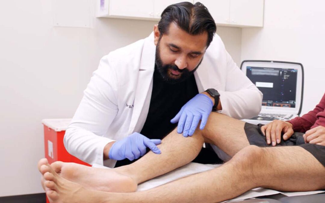 Best Vein Treatment for Varicose Veins in Hoboken, NJ