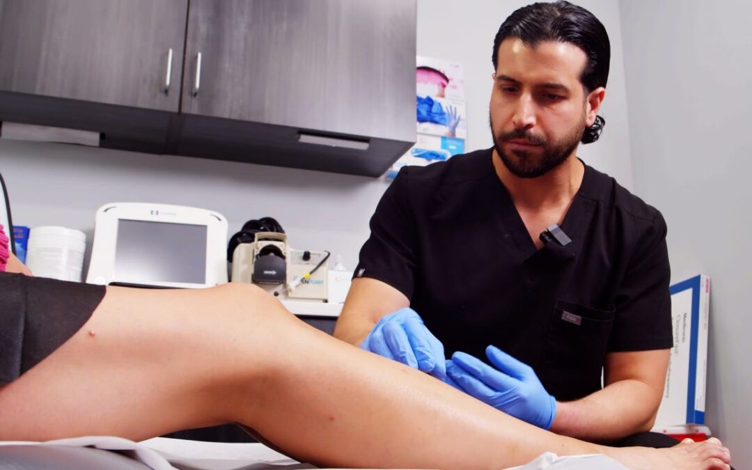 When Is the Perfect Time to See a Vein Specialist?