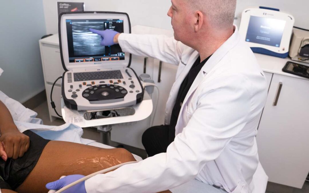 Why Treat Your Spider Veins at Upper East Side, NY Vein Clinic