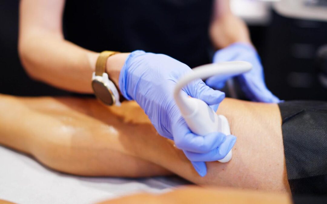 What Insurance Companies in the USA Cover Vein Treatments?