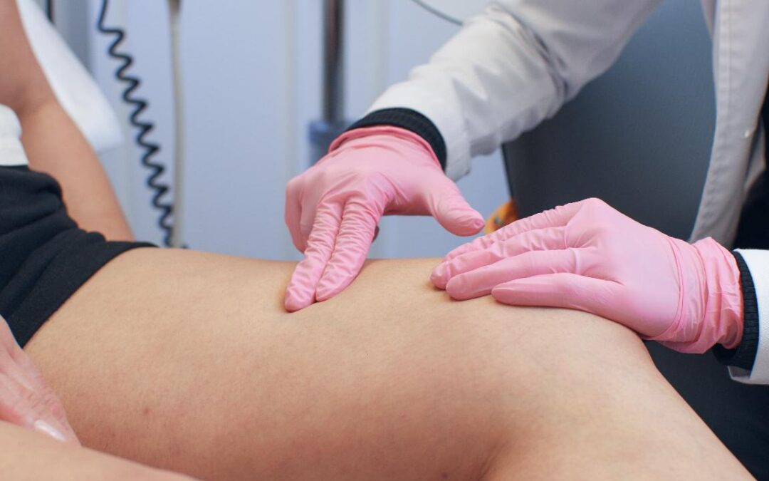 Your Insurance Can Help You Treat Your Venous Insufficiency!
