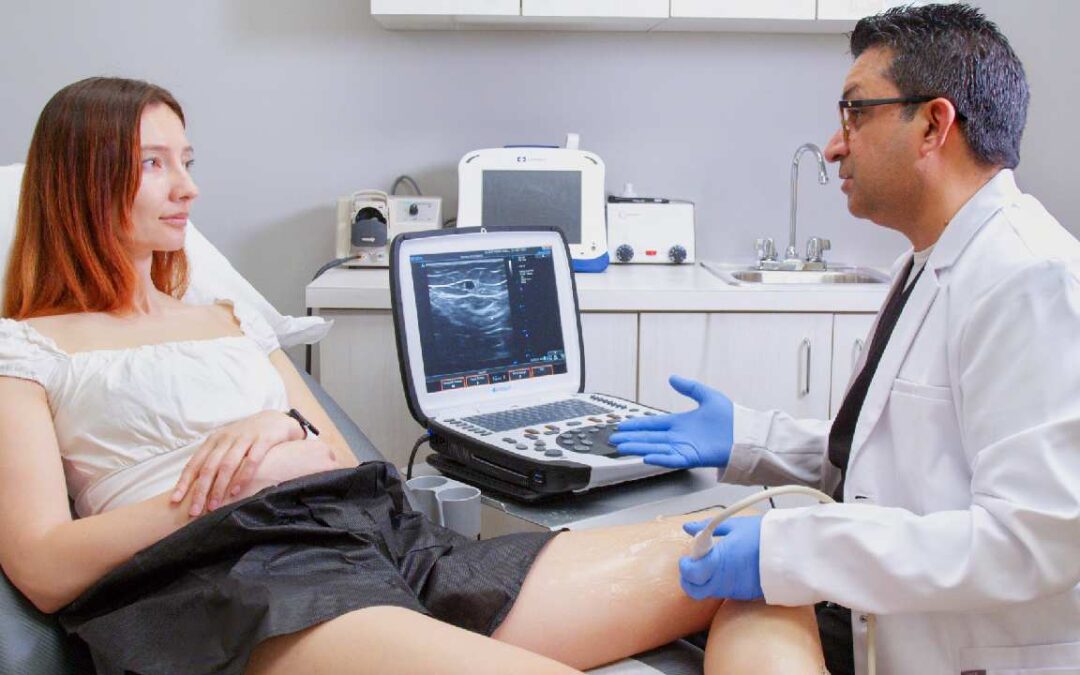 How to Reverse Varicose Veins? Is It Possible?