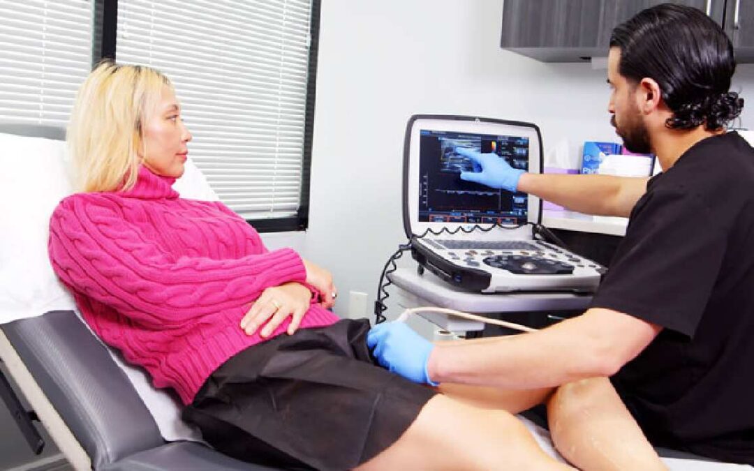 5 Spider Vein Treatments at Home: Do They Work?