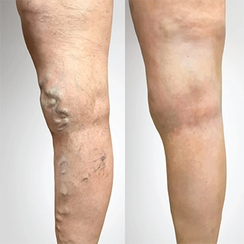 Before and After Our Top-tier Treatment