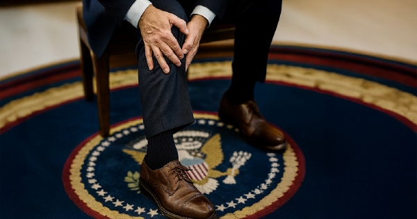 Trump’s CVI diagnosis: What chronic leg swelling says about your vein health