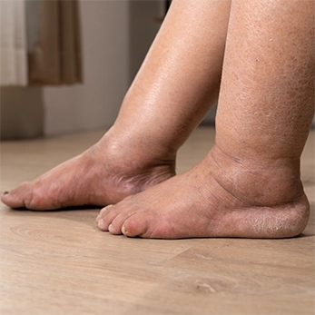 We Offer Top-tier Vein Disease Treatments