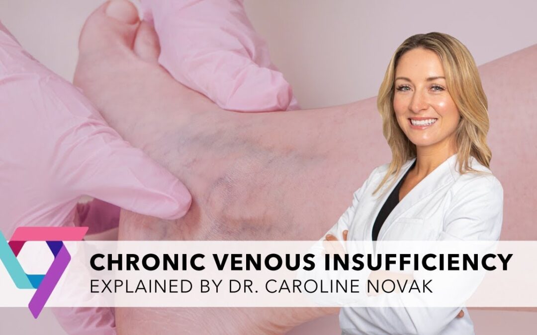 Causes of Venous Insufficiency and How a Reputable Vein Treatment Center Can Diagnose and Treat You