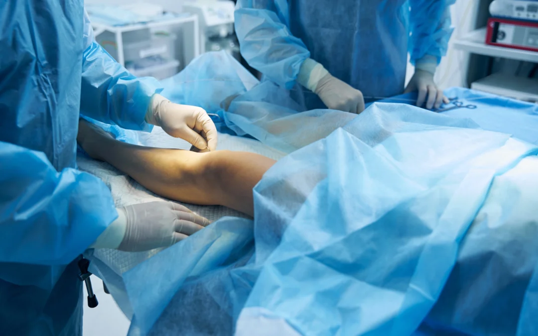 Leading Varicose Vein Treatments Offered in Maple Lawn, MD