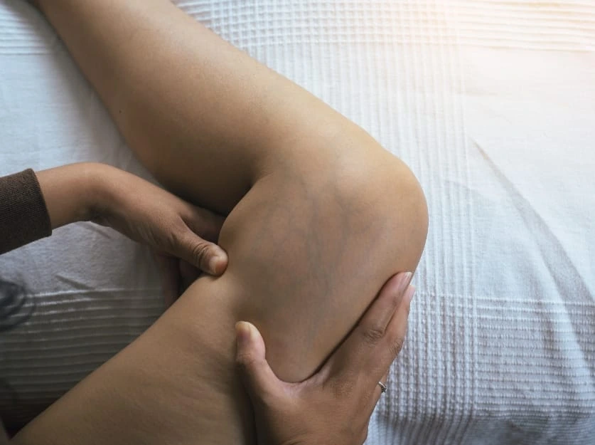 Top Venous Insufficiency Treatments in Maple Lawn, MD Vein Clinic