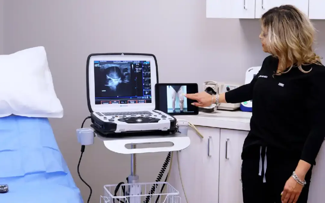 Varicose Vein Removal in Farmington, CT