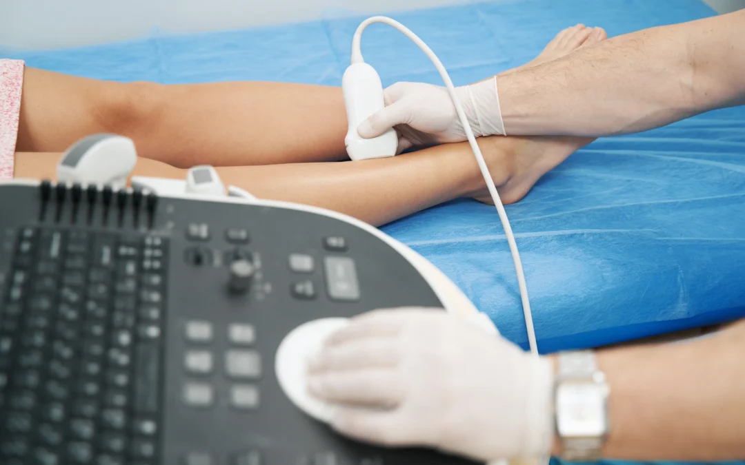 Treat Your Varicose Veins in Hamden, CT With Dr. Martin Tyson