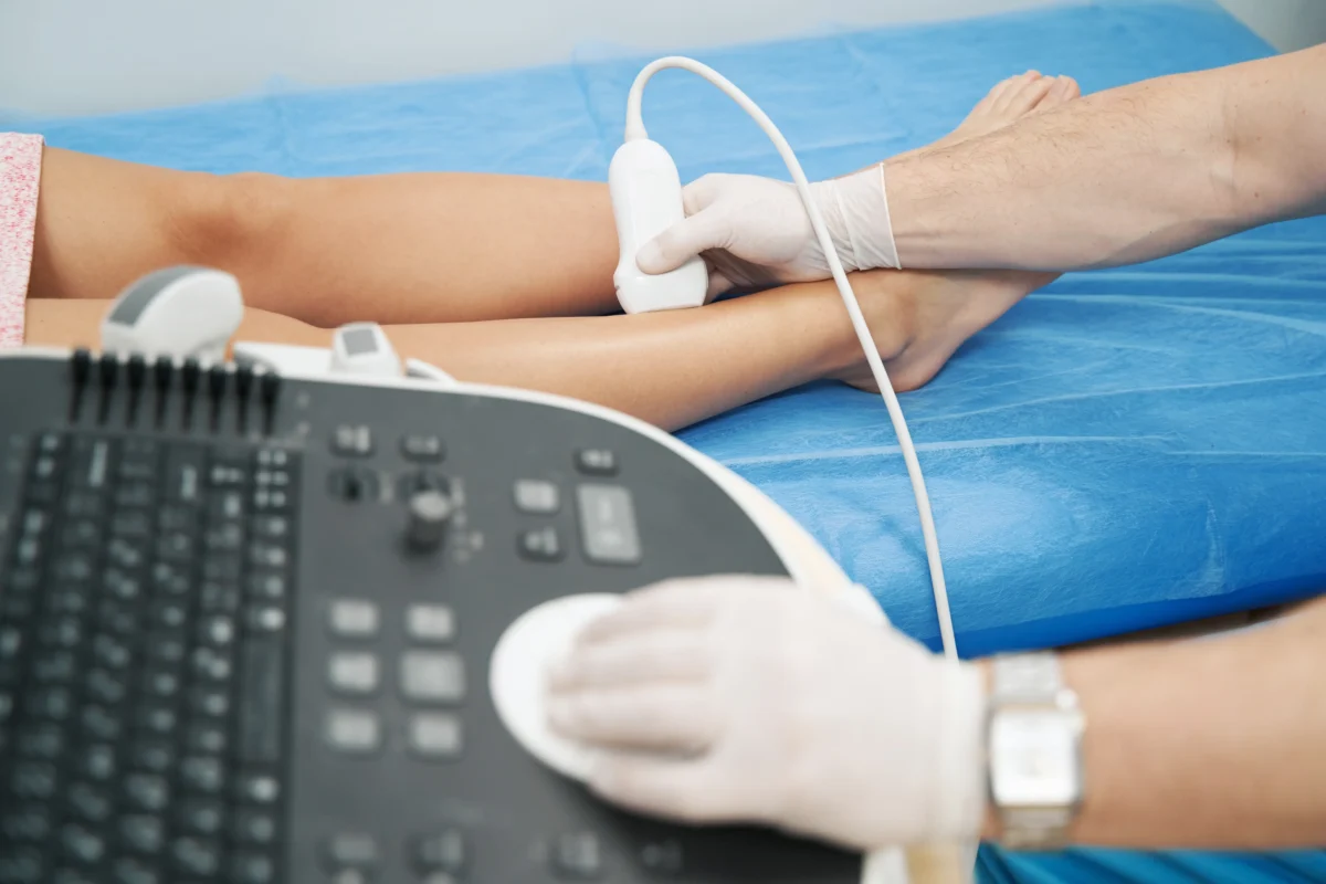 Treat Your Varicose Veins in Hamden, CT With Dr. Martin Tyson