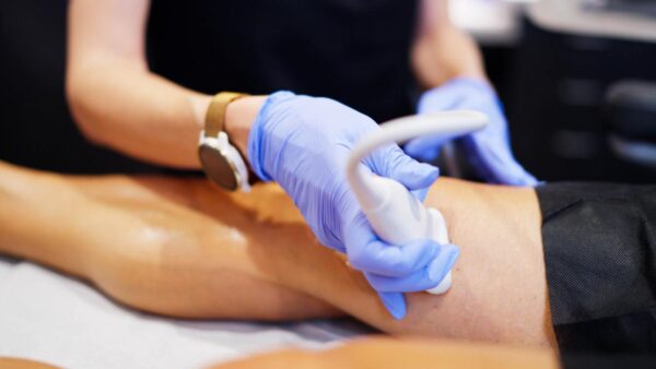 What Insurance Companies in the USA Cover Vein Treatments?