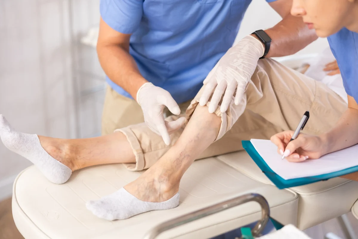 What Is the Best Doctor to Treat Leg Swelling and Heaviness?