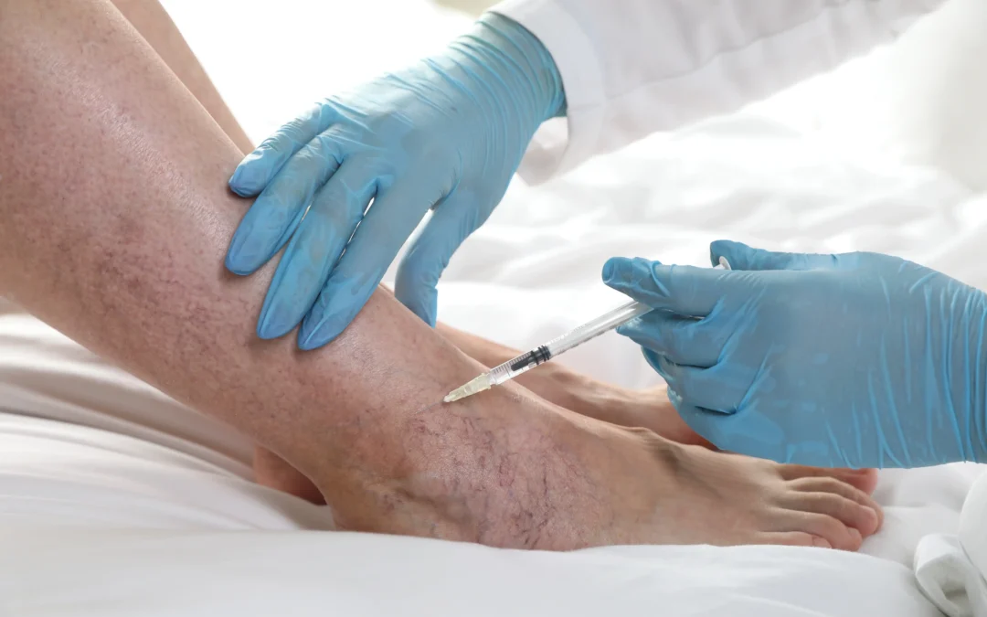 What’s the Fastest Way to Start Vein Treatment?
