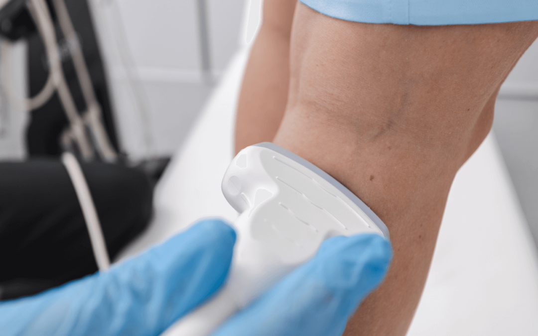 Which Clinic Specializes in Minimally Invasive Vein Treatments?