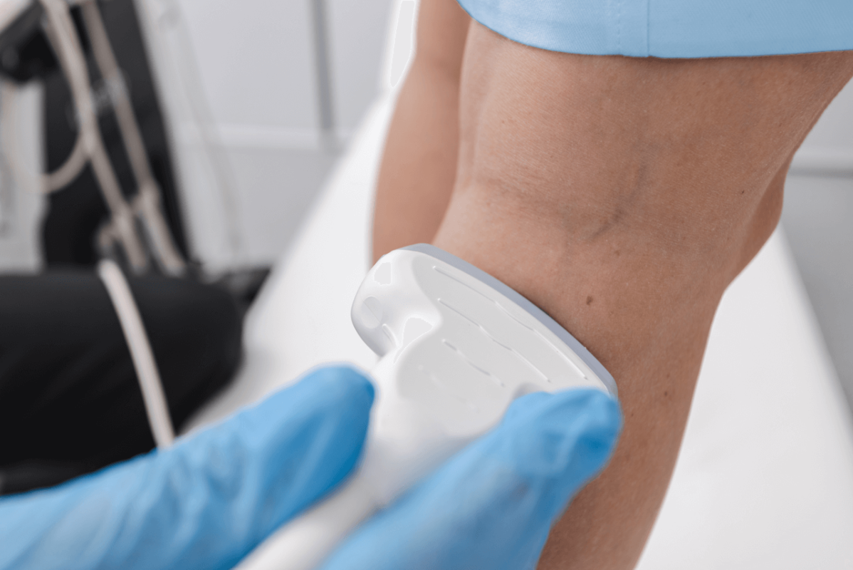 Which Clinic Specializes in Minimally Invasive Vein Treatments?