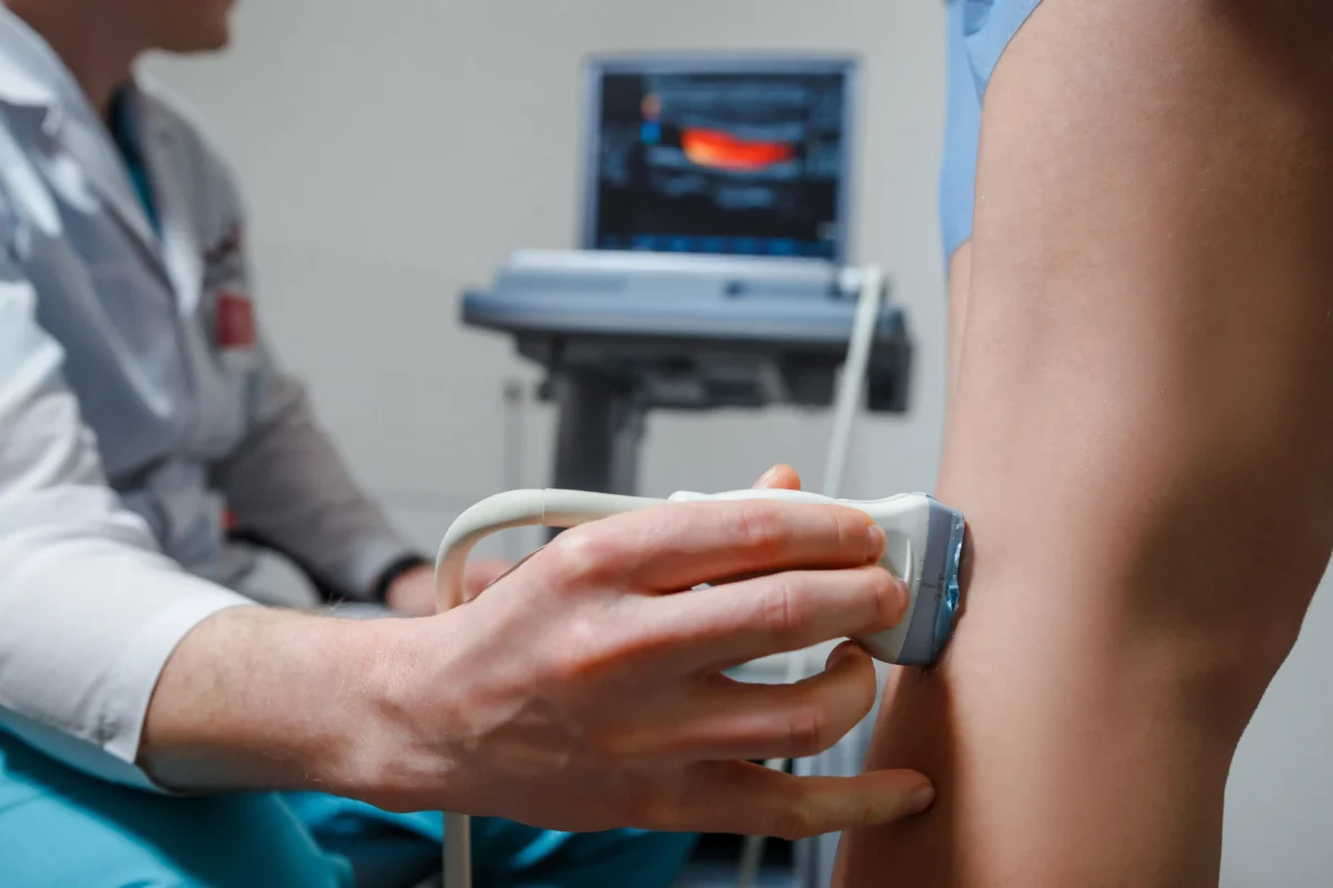 Where to Get Radiofrequency Ablation (RFA) for Varicose Veins
