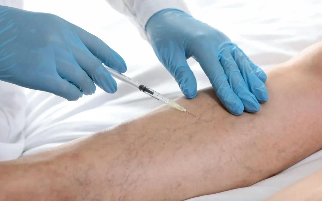 Find the best clinic to treat Spider Veins