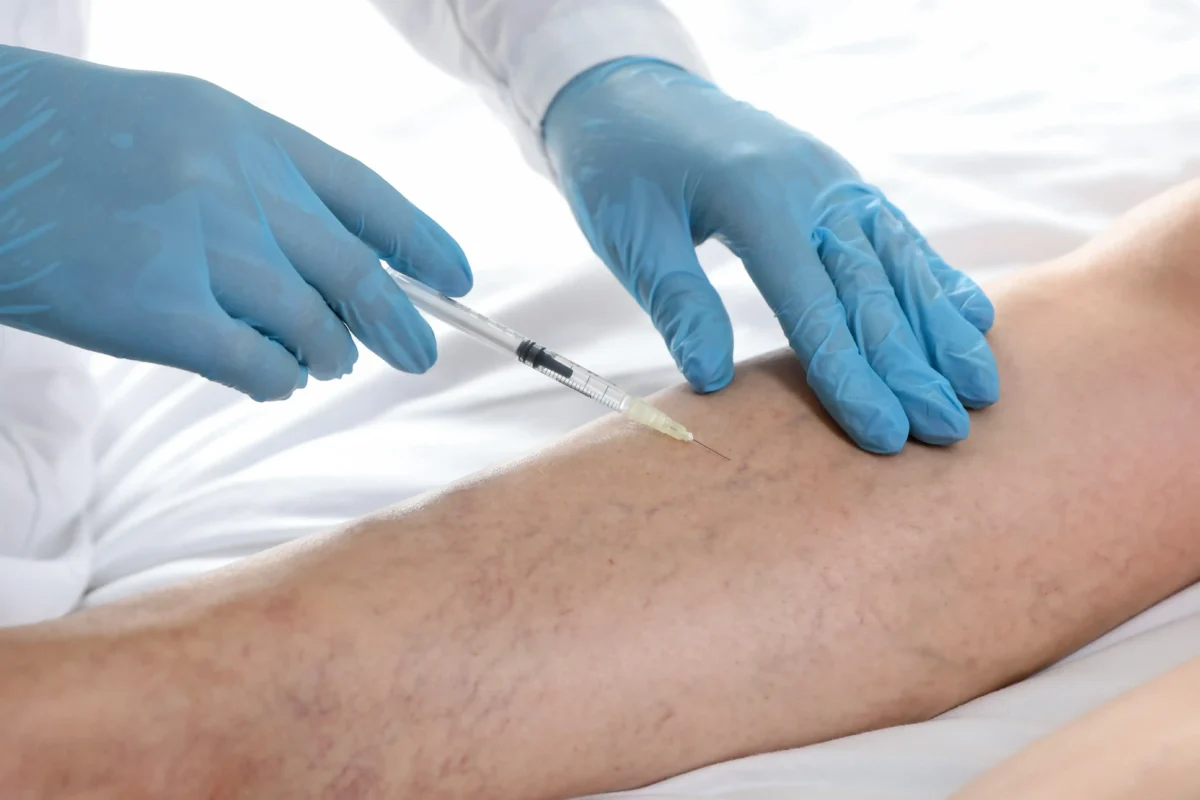 Find the best clinic to treat Spider Veins