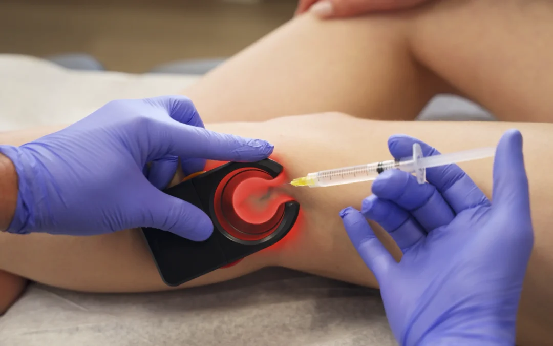 Get Spider Veins Treated in  Fort Worth, Texas