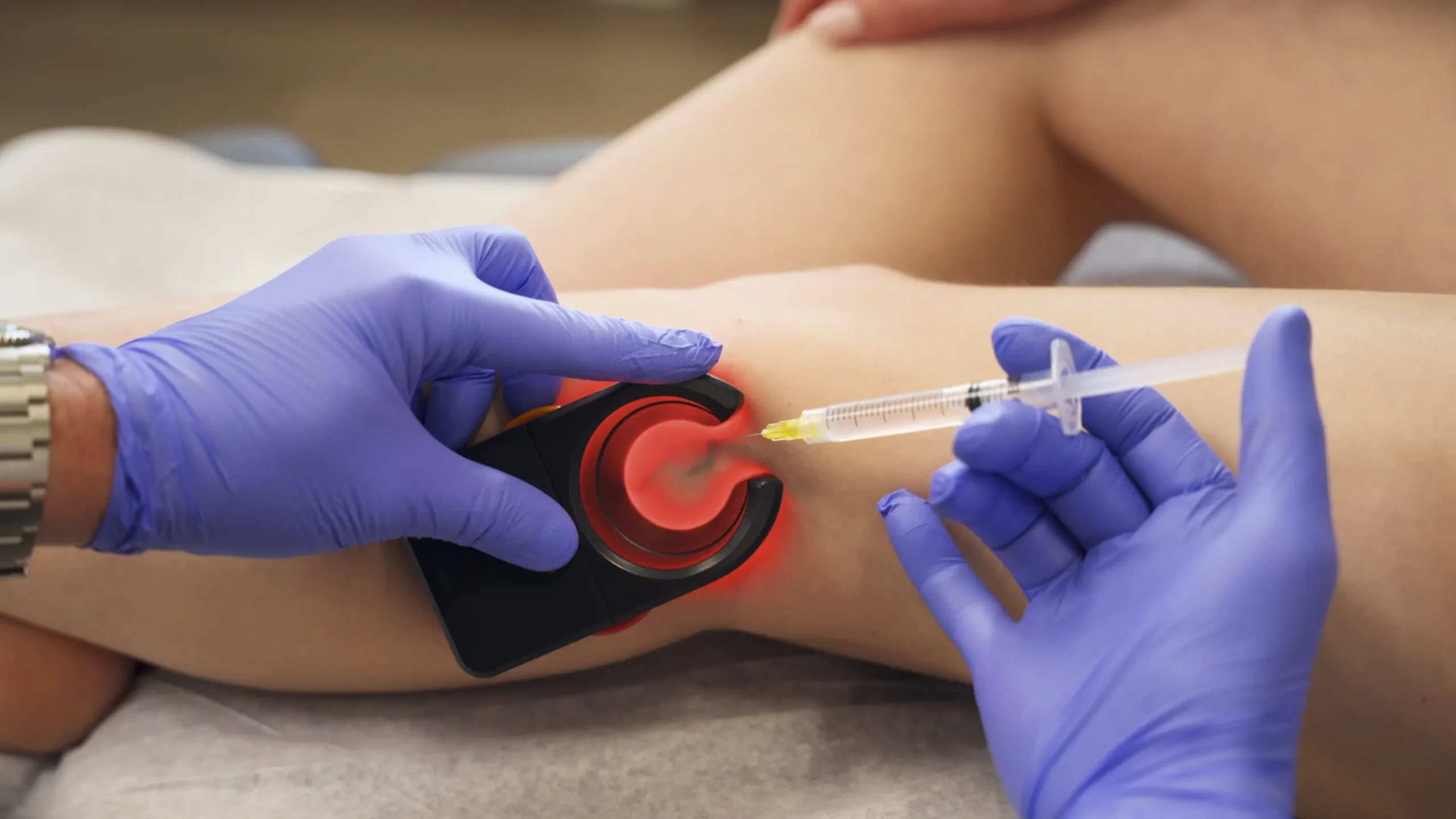 does fibroid removal affect hormones?