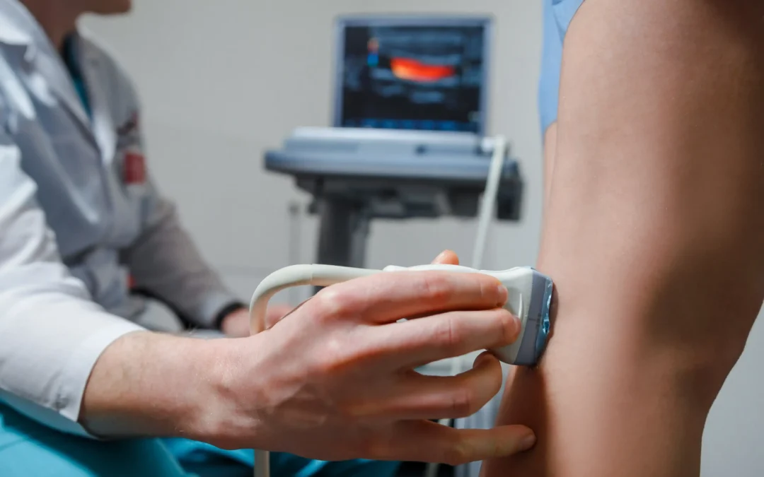 Astoria’s Best Vein Clinic for Restless Leg Syndrome and Circulation Treatment