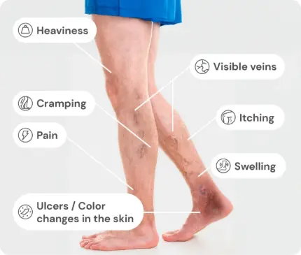 An educational infographic titled "Symptoms for Venous Insufficiency" showing a person's legs from the mid-thigh down. The legs display visible varicose veins and skin discoloration near the ankle. Seven callout labels point to different areas, listing common symptoms: Heaviness, Visible veins, Cramping, Itching, Pain, Swelling, and Ulcers / Color changes in the skin.