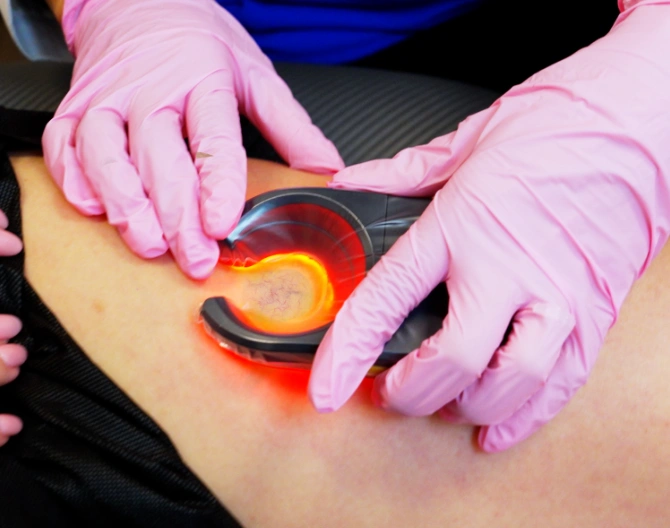 How to Choose a Vein Doctor in New Jersey