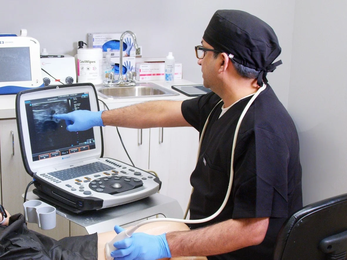 does fibroid removal affect hormones?